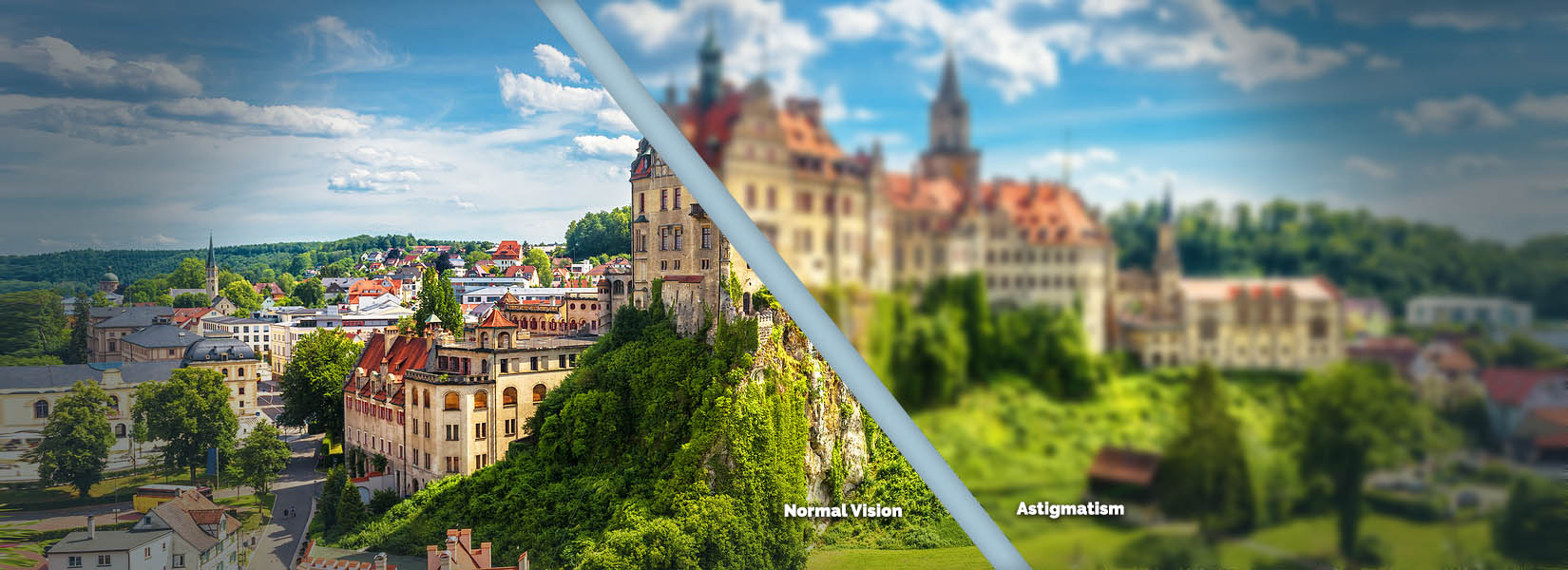 Astigmatism Treatment in Alexandria